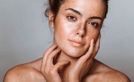 Your skin - woman skin's pigmentation